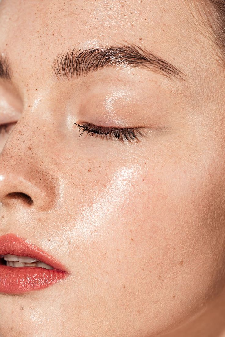 Oily Skin