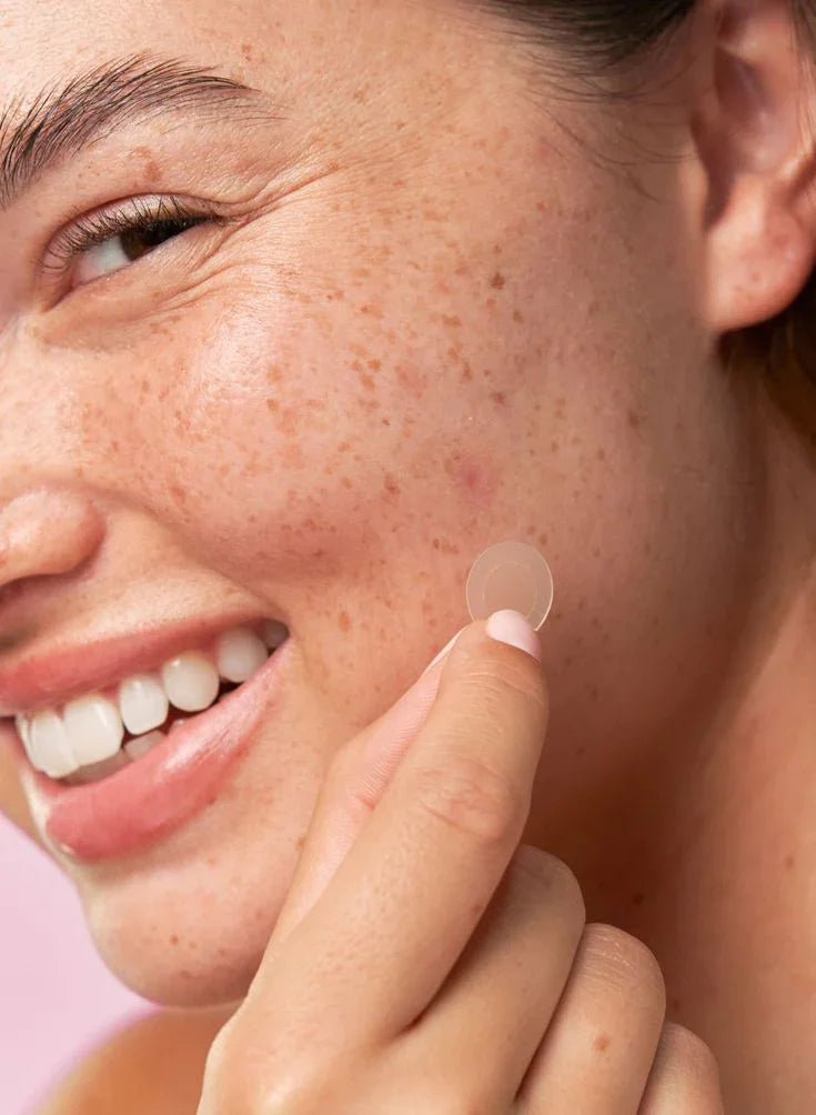 Pimples & Dark Spots